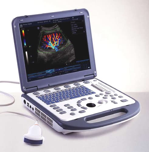 Mindray M5 Digital Ultrasound